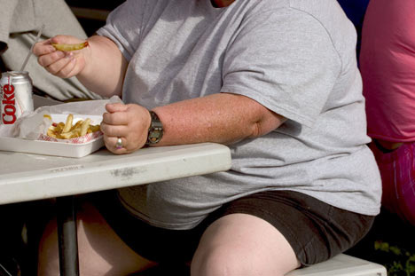 obesidad_tratamiento_tracto.jpg