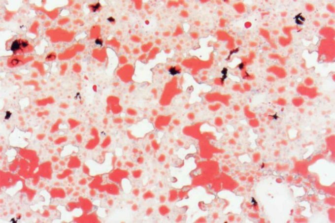 Beneficios de introducir en la dieta laTrehalosa